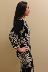 Weight Loss 2 - After Treatment